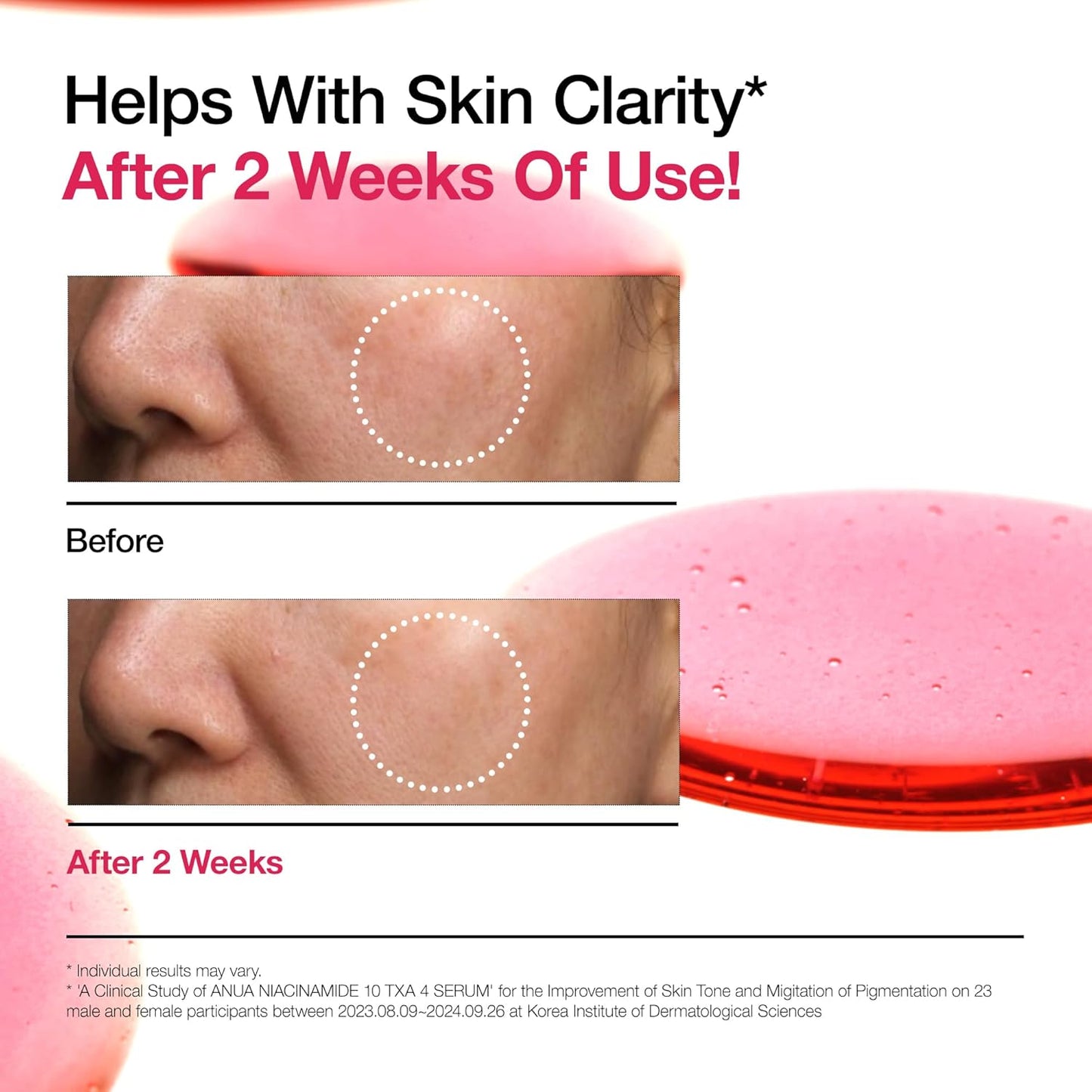 Niacinamide 10% + TXA 4% Dark Spot Correcting Serum 30ml