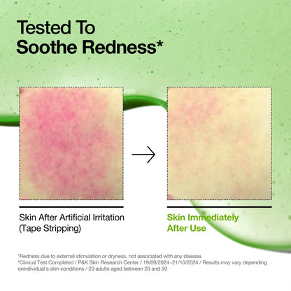 Azelaic Acid 10 Hyaluron Redness Soothing Serum 30ml